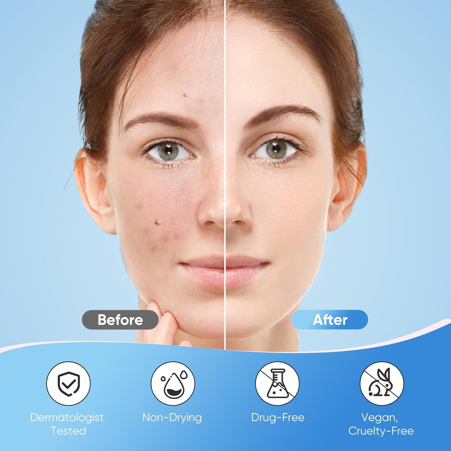 Pimple Patches for Face, Hydrocolloid Acne Patches, Sparkling Star Zit Covers, Colorful Spot Stickers with Tea Tree, Salicylic Acid & Cica Oil| 3 Sizes (10Mm, 12Mm & 14Mm) |240 Count